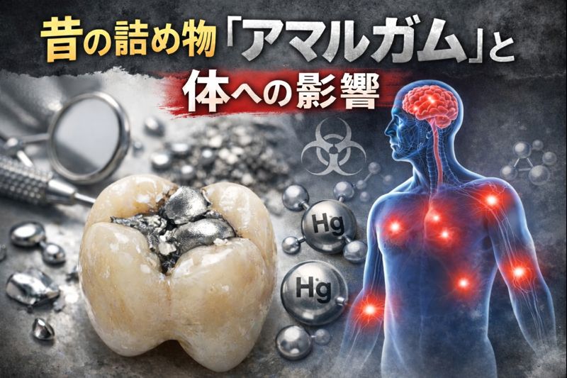 昔の詰め物「アマルガム」と体への影響