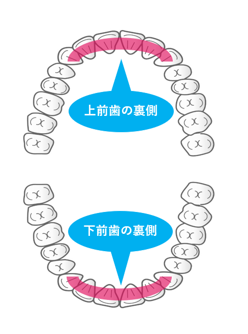 前歯の裏側を示す図：医療法人福涛会