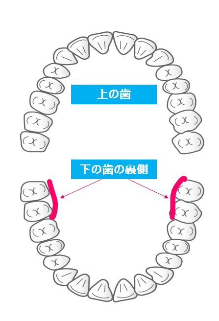 下の歯の裏側を示す図：医療法人福涛会