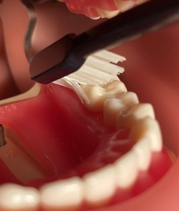 下の奥歯の裏側歯ブラシの当て方：医療法人福涛会