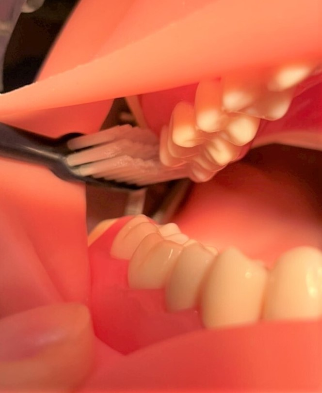 最後臼歯遠心（さいごきゅうしえんしん）の磨き方の図：医療法人福涛会