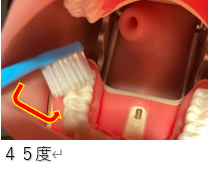 六歳6臼歯の磨き方　医療法人福涛会