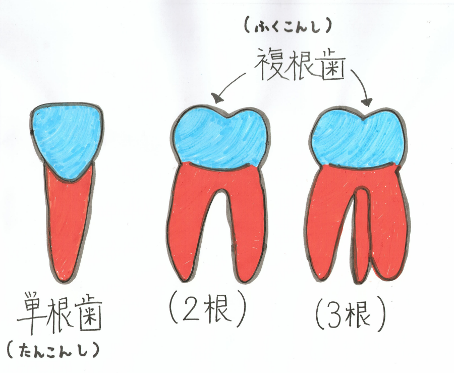 生えている位置によって歯の根っこの数は違うって知ってました？？？。単根歯・複根歯（２根・３根）。